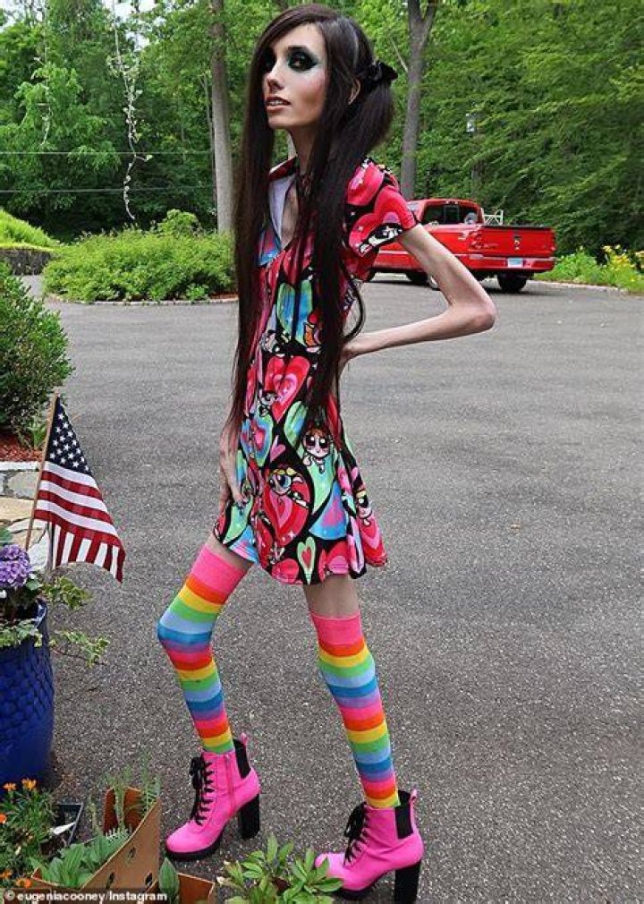 Anorexic Girl
