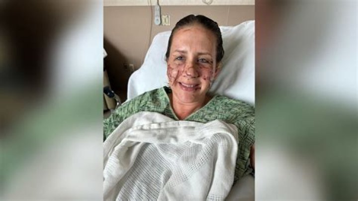 Attacked Woman