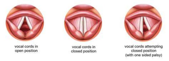 Newborn Vocal #2