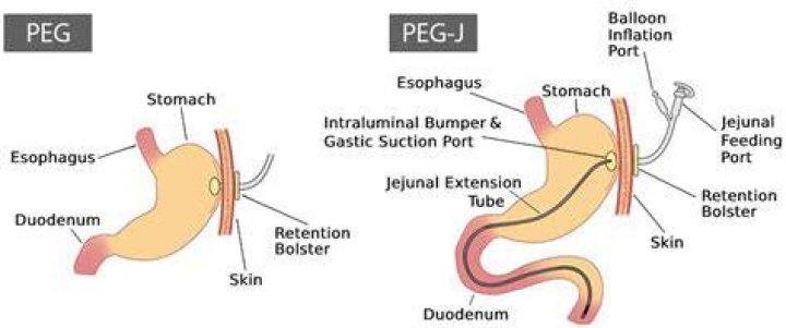 Peg