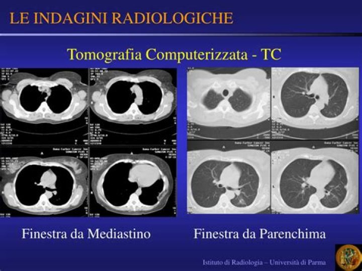 T.C. Finestra